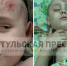 В «Золотом городе» на ребенка упала скульптура: подробности происшествия - ИА Тульская пресса.Ru