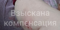 Администрация Тулы заплатит 20 тысяч рублей инвалиду за укус собаки - ИА Тульская служба новостей