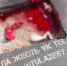 В Туле на улице Макаренко женщине стало плохо - ИА Тульская служба новостей