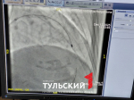 В Ваныкинскую больницу Тулы завезли новый аппарат ротаблатор