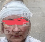 Пыталась оттащить, а на меня набросились: администратор рассказала о том, как получила травмы в ходе конфликта